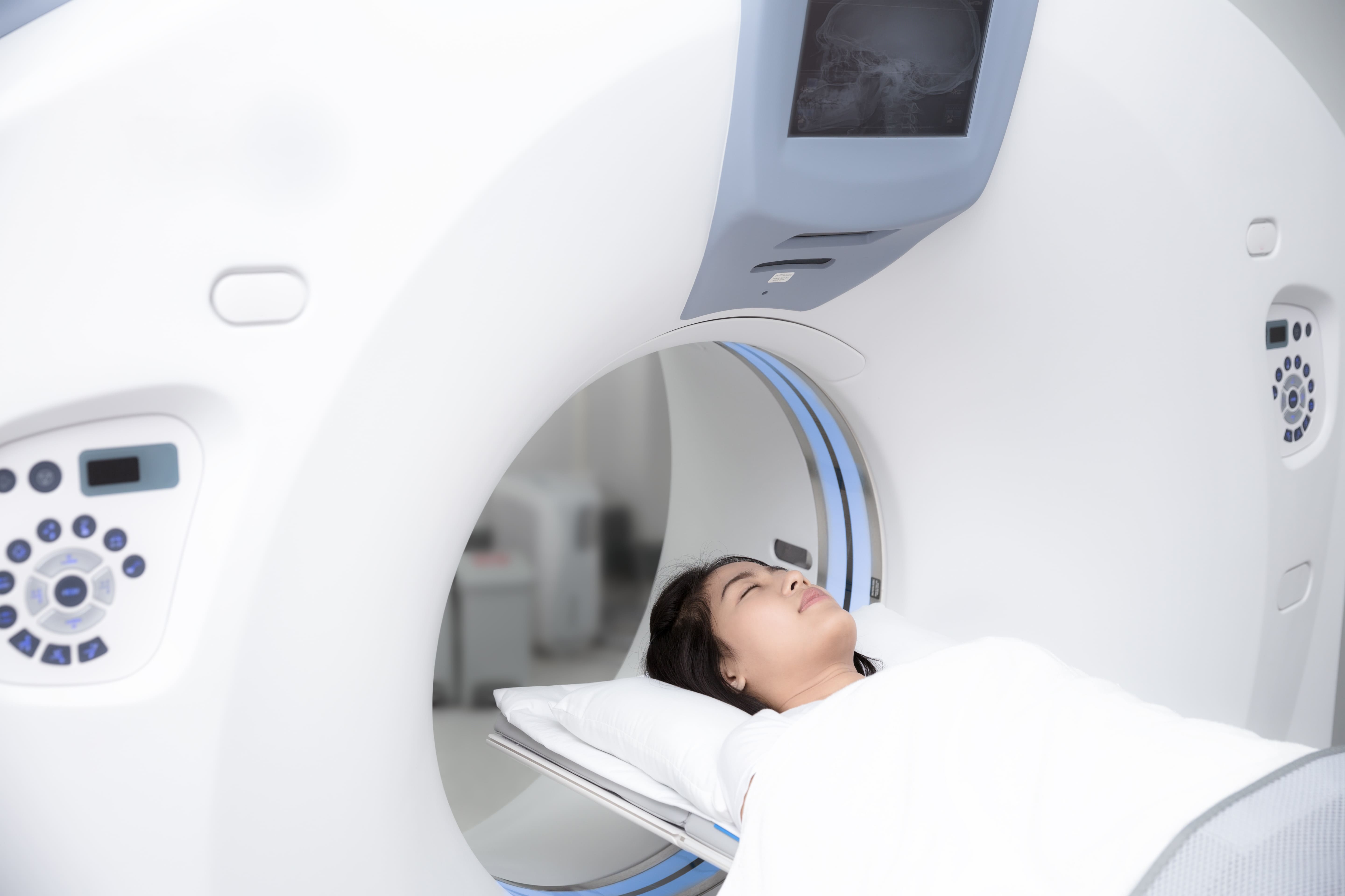 検査機器（CT）で横たわる受診者
